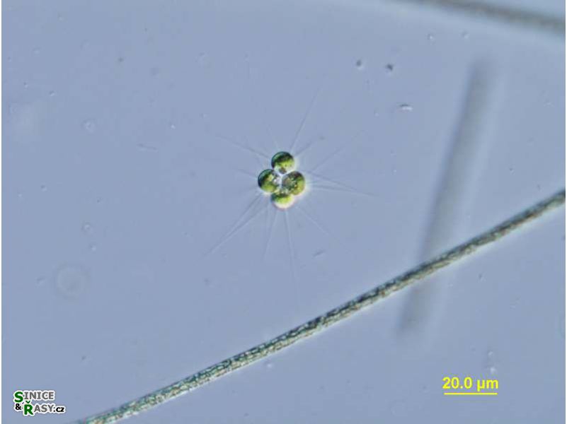 Micractinium pusillum