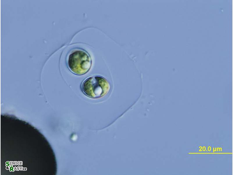 Oocystis lacustris