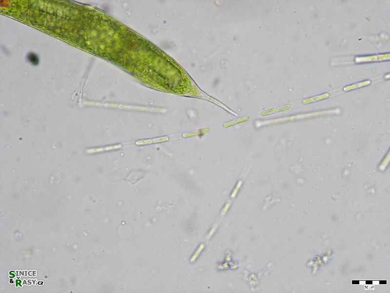 Binuclearia lauterbornii