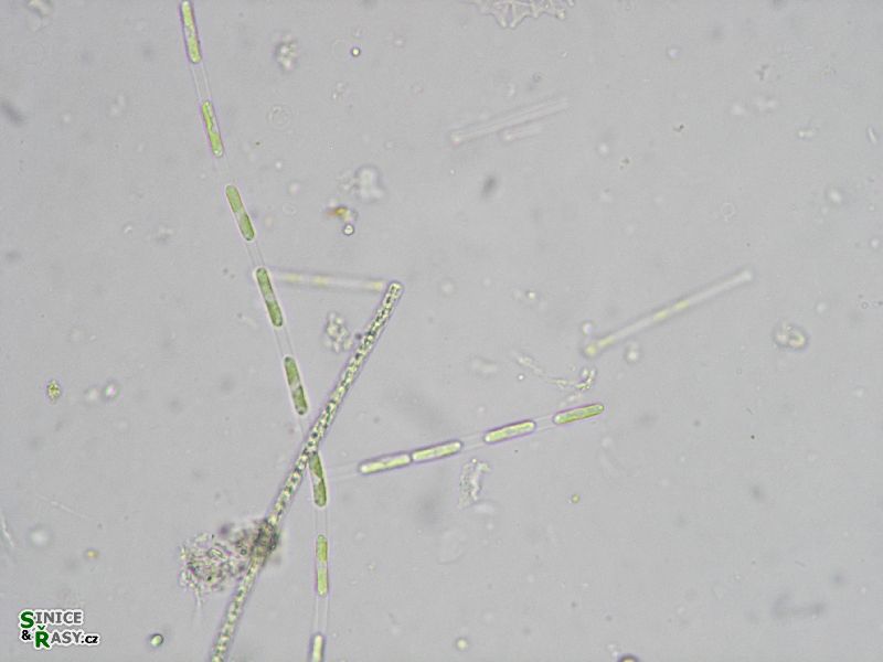 Binuclearia lauterbornii