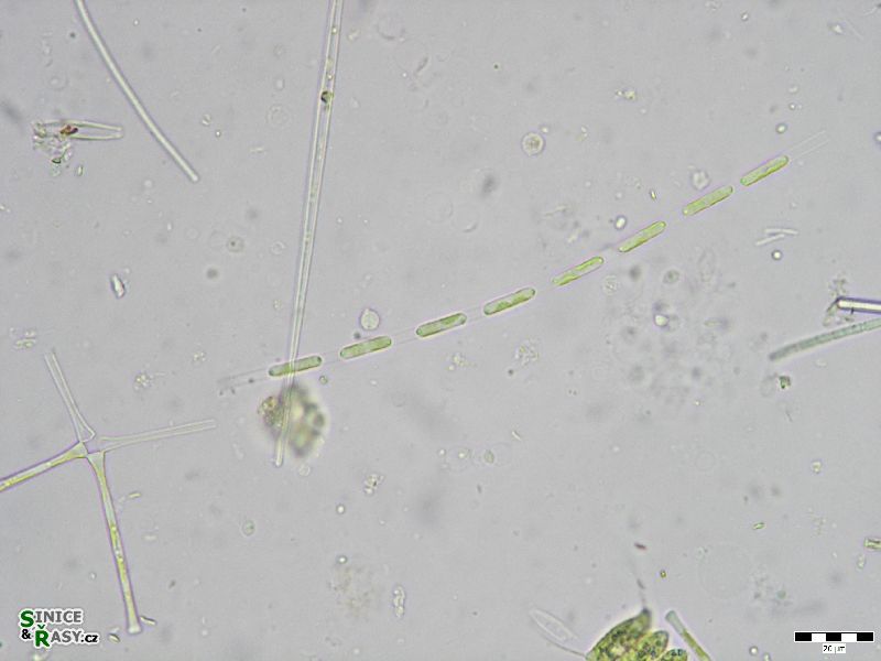 Binuclearia lauterbornii