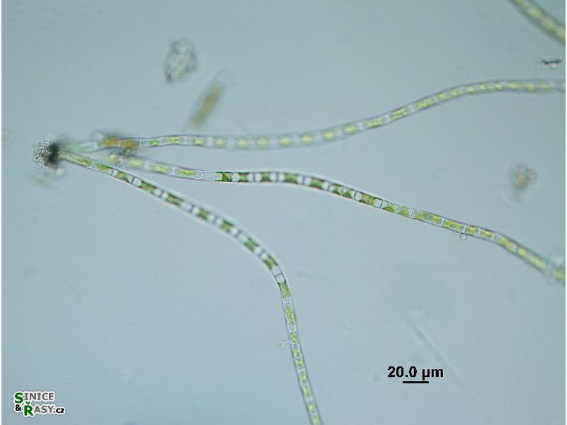 Rhizoclonium sp.