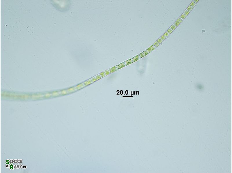 Rhizoclonium sp.