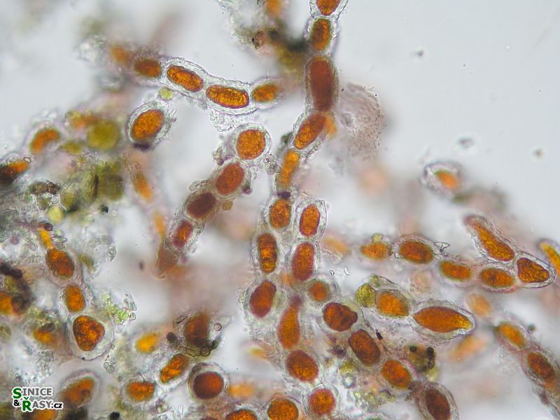 Trentepohlia