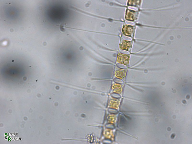 Chaetoceros sp.