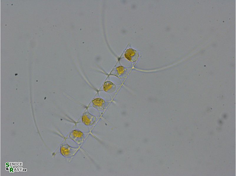 Chaetoceros sp. 