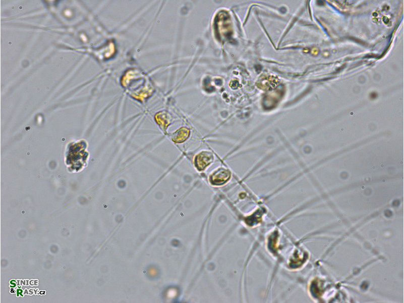 Chaetoceros sp. 