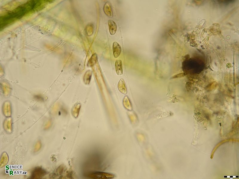 Encyonema