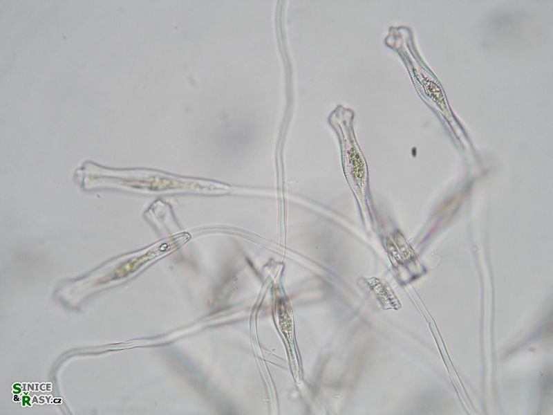 Gomphonema acuminatum
