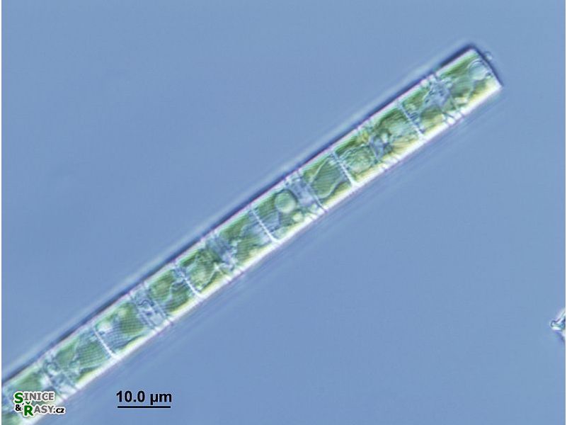 Melosira varians