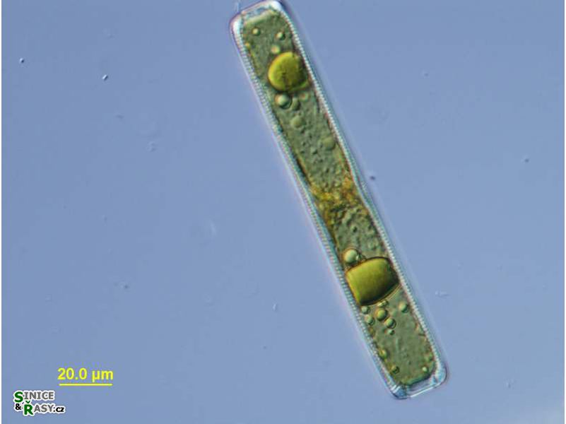 Pinnularia