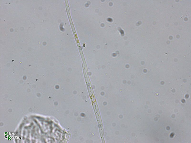 Pseudonitzschia pseudodelicatisima