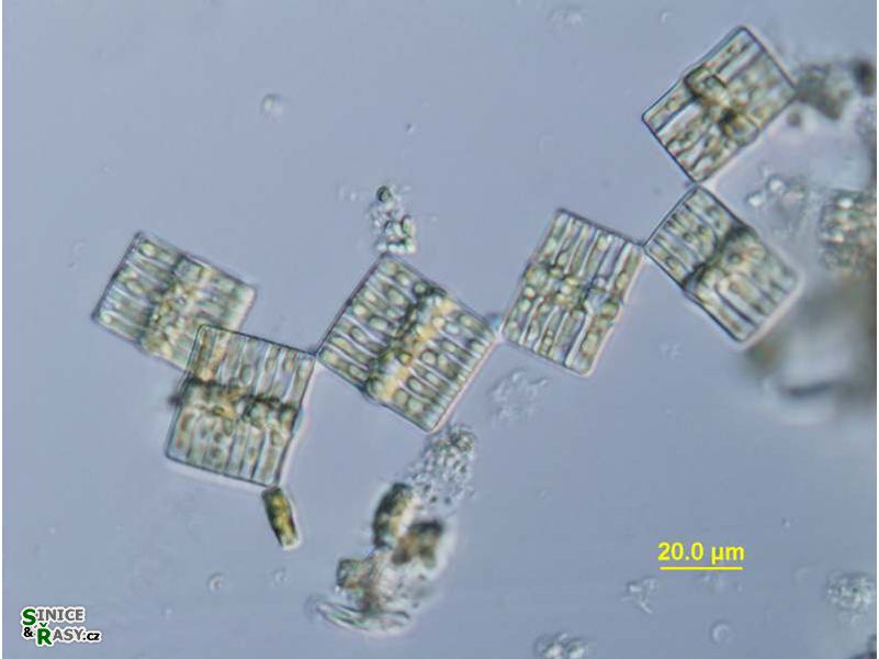Tabellaria flocculosa