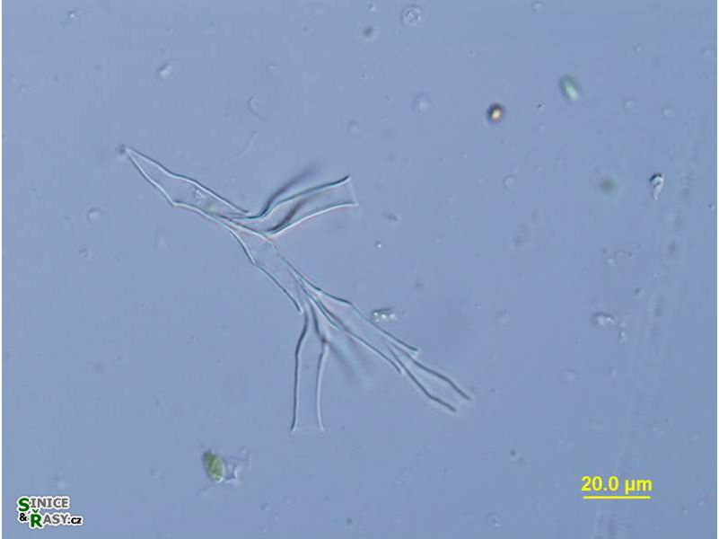 Dinobryon divergens