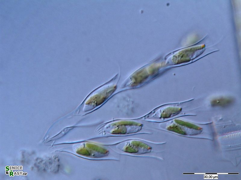 Dinobryon sertularia
