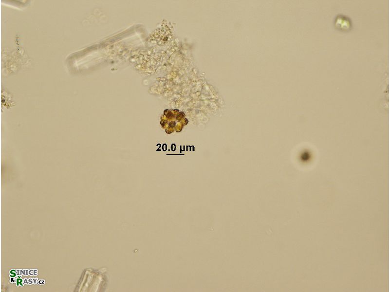 Synura cf. echinulata