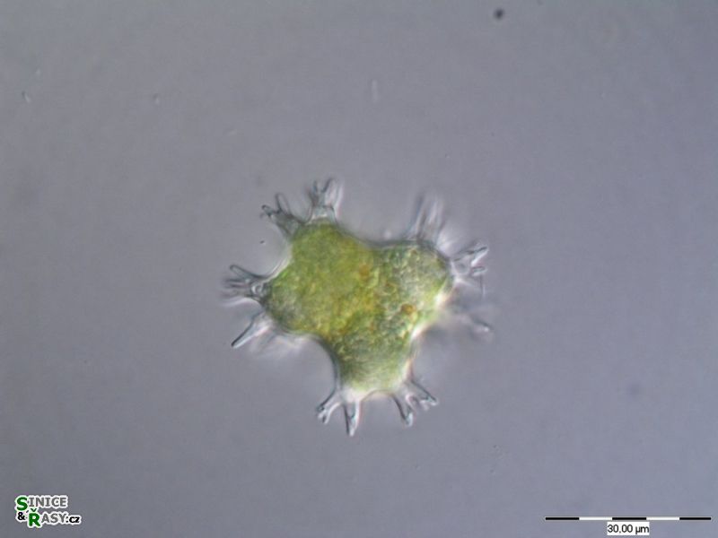 Pseudostaurastrum enorme