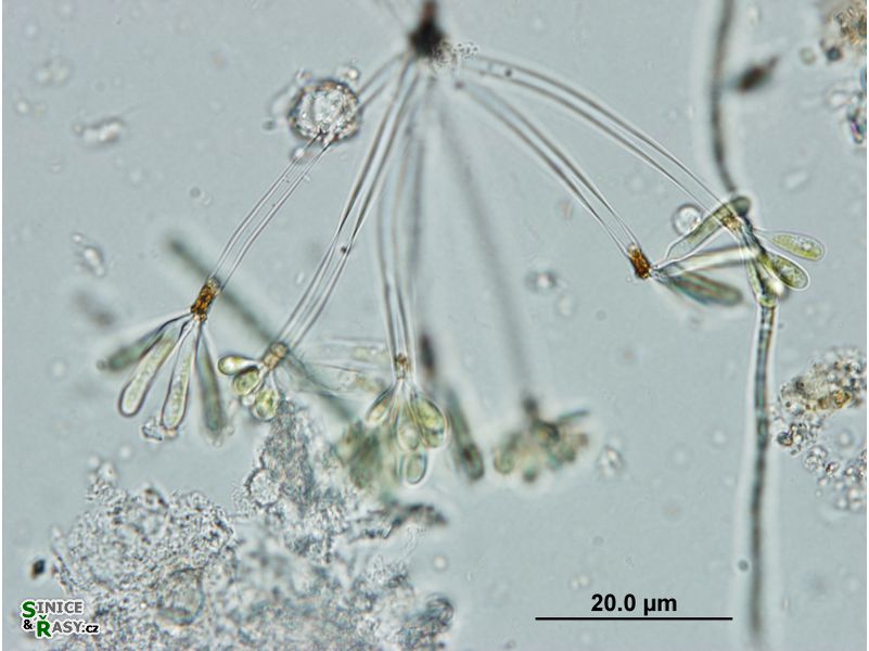Ophiocytium arbuscula