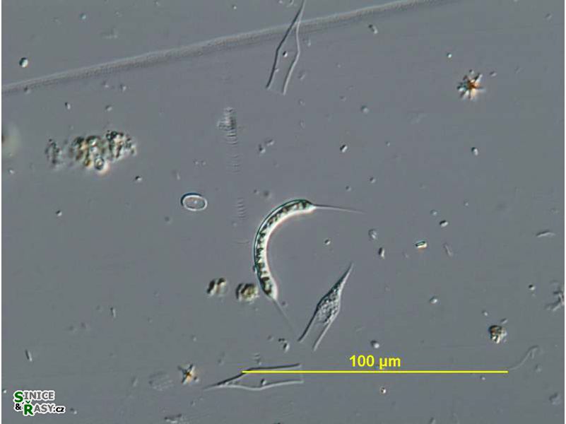 Ophiocytium