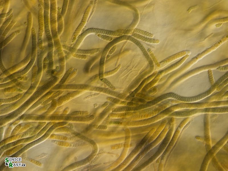 cf. Scytonematopsis