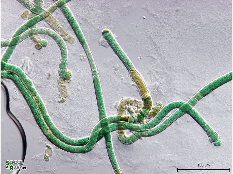 Scytonema cf. hyalinum