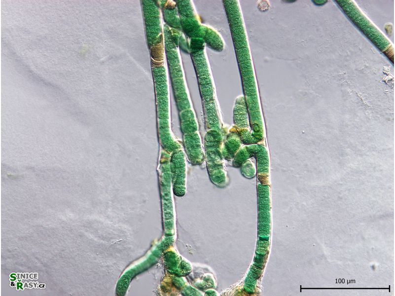 Scytonema hyalinum