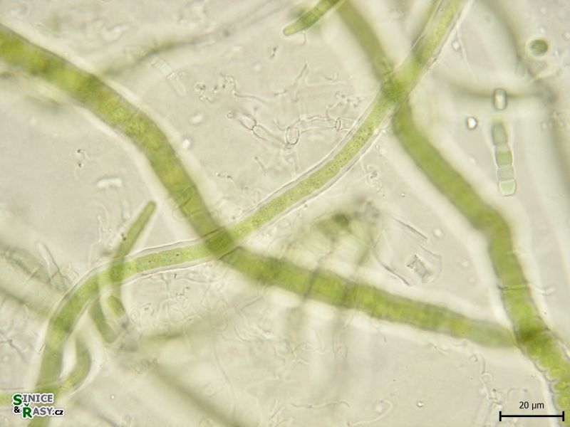 Calochaete