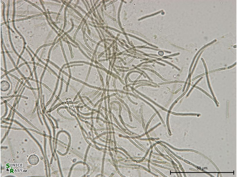 Leptolyngbya