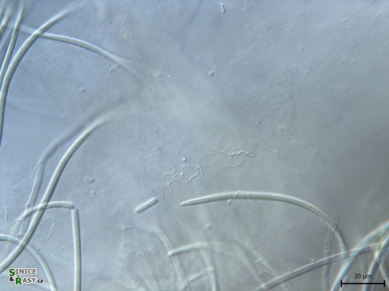 Leptolyngbya