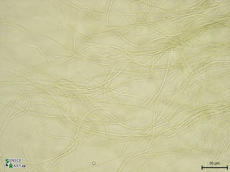 Leptolyngbya