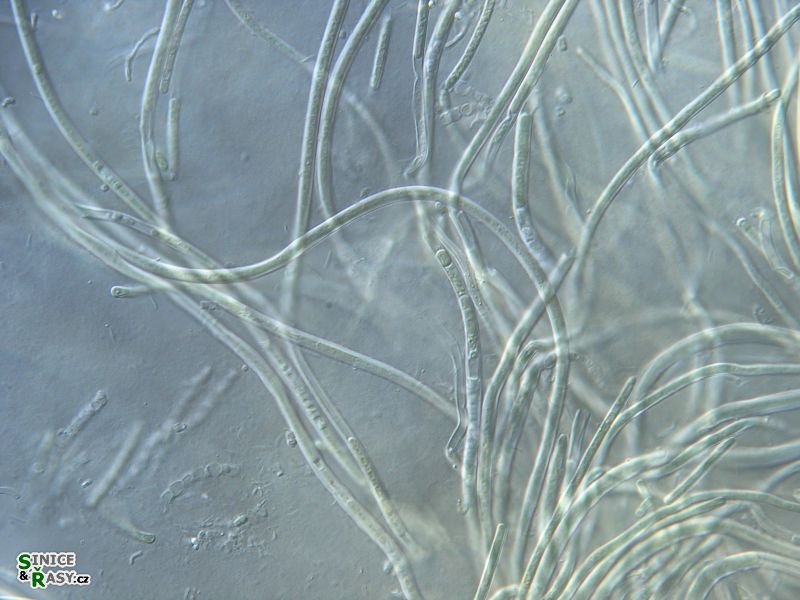 Leptolyngbya