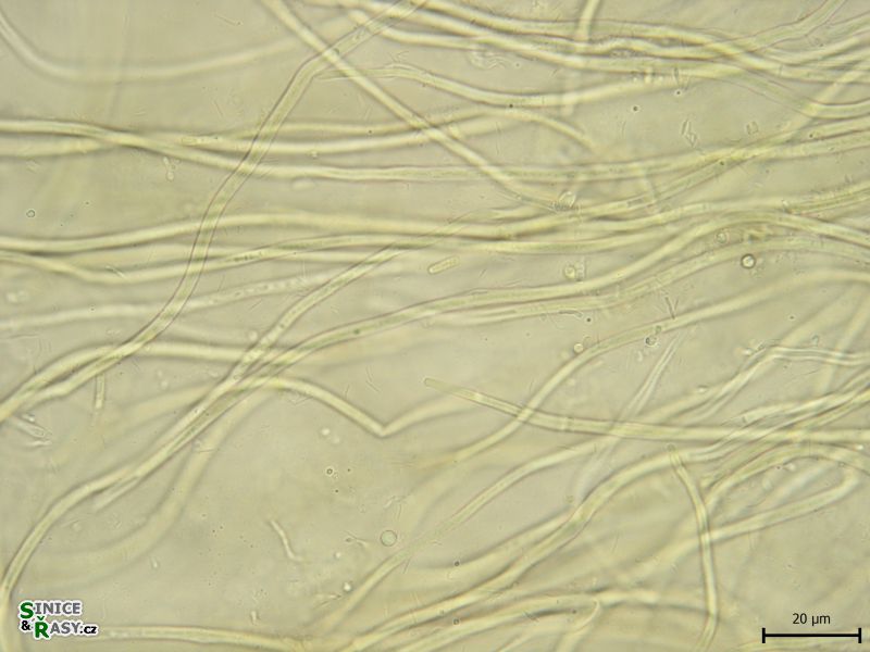 Calochaete