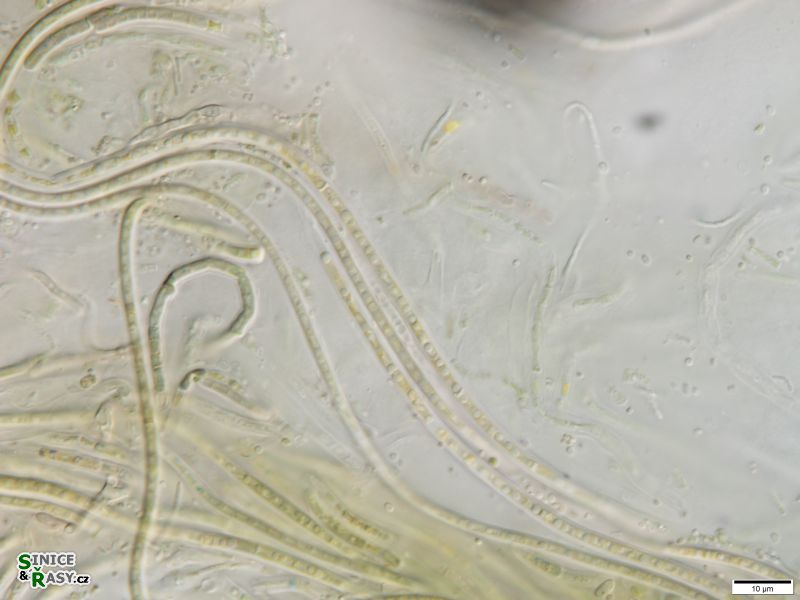 Leptolyngbya