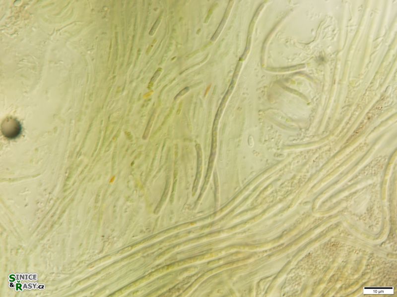 Leptolyngbya