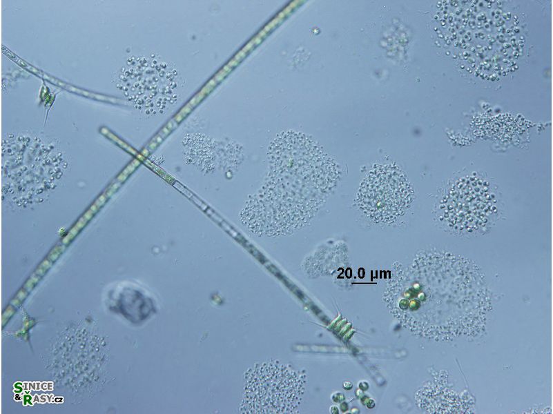 Aphanocapsa