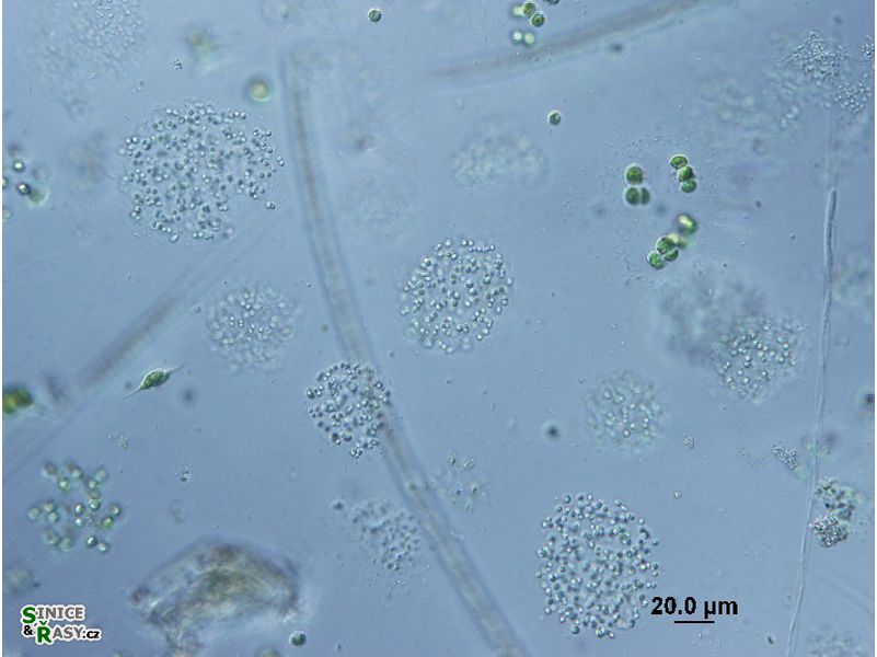 Aphanocapsa