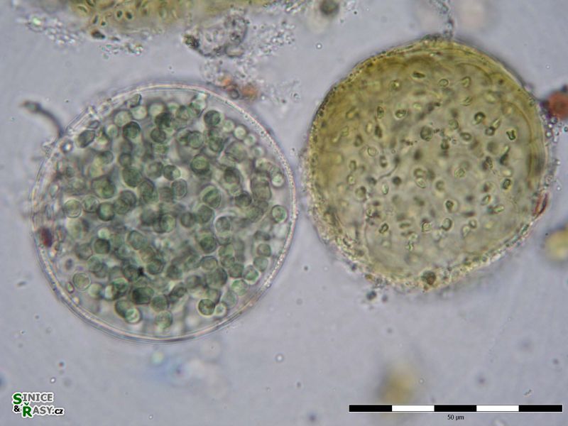Aterocapsa cf. belizensis