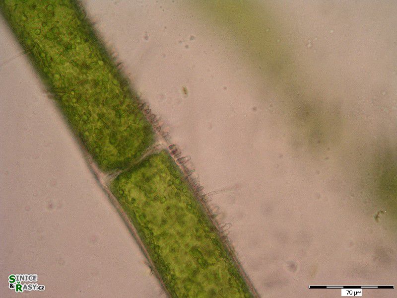 Chamaesiphon sp.