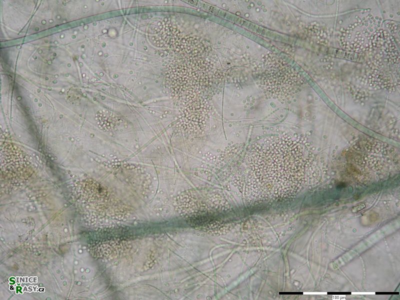 Chlorogloea gardneri
