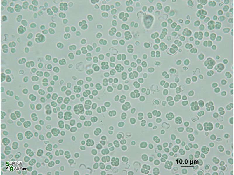 Chroococcidiopsis cubana