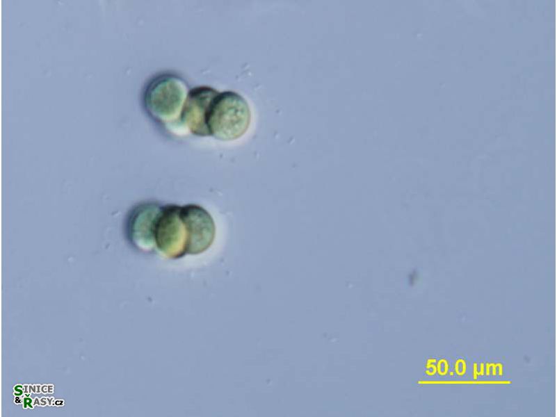 Chroococcus limneticus