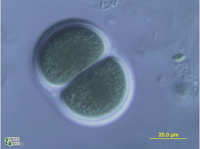 Chroococcus turgidus var. maximus