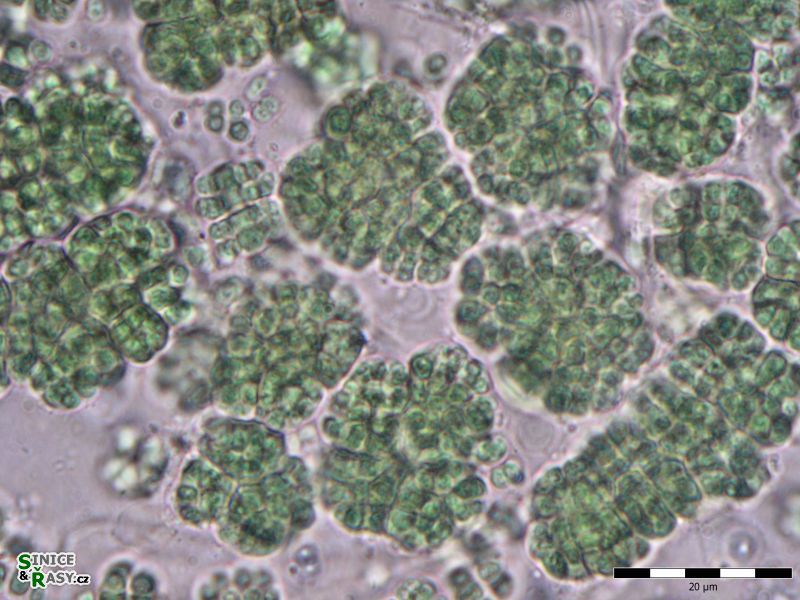 Cyanosarcina cf. thalassia