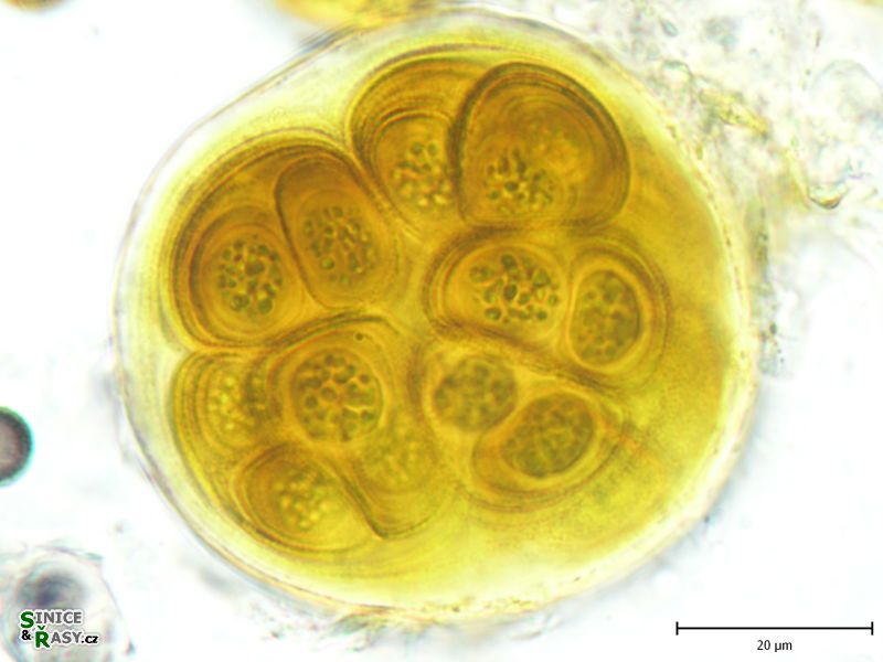 Gloeocapsa rupestris