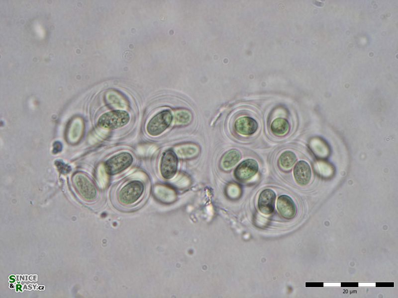 Gloeothece interspersa