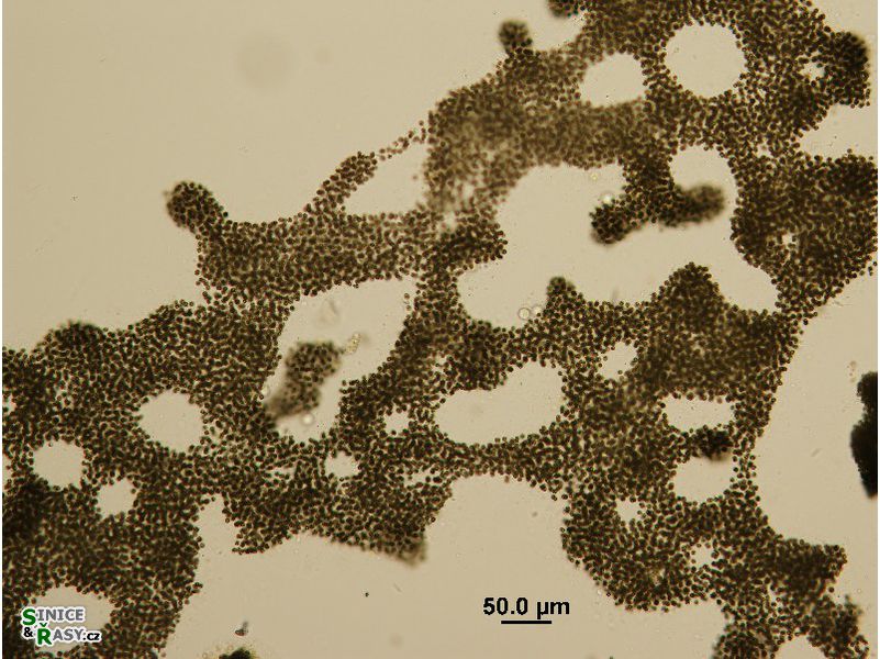 Microcystis aeruginosa