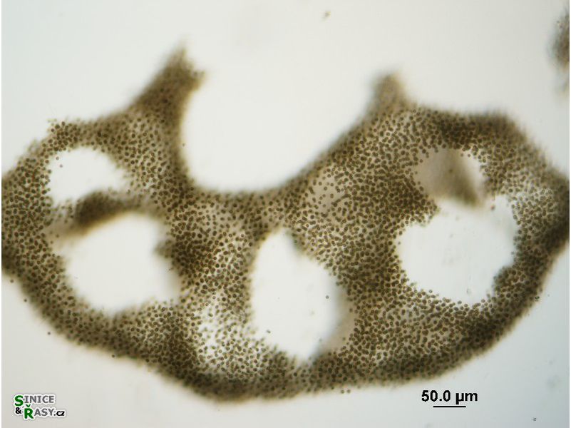 Microcystis aeruginosa