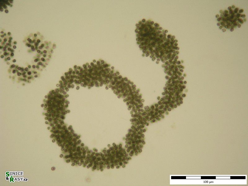 Microcystis aeruginosa