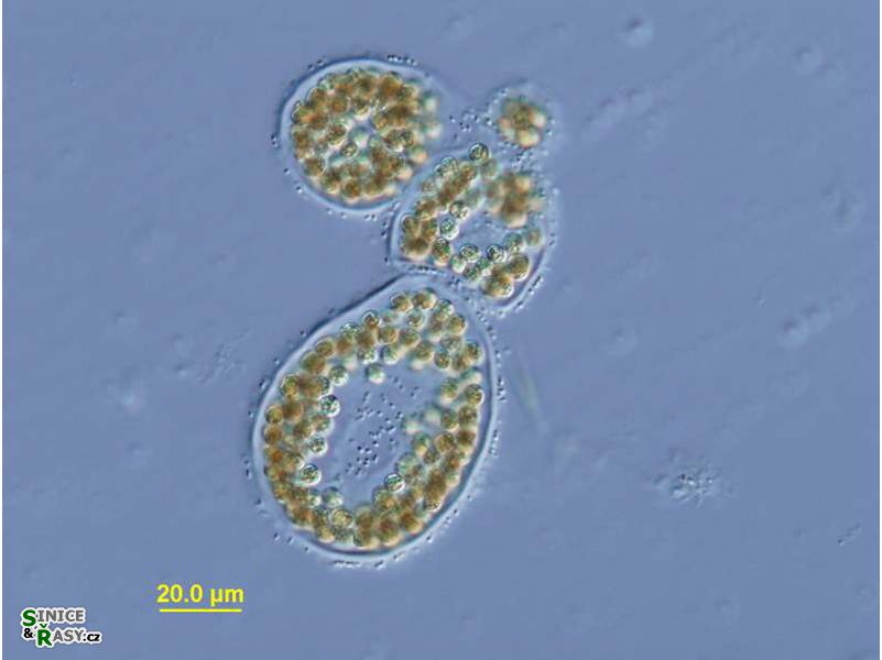 Micorcystis wesenbergii