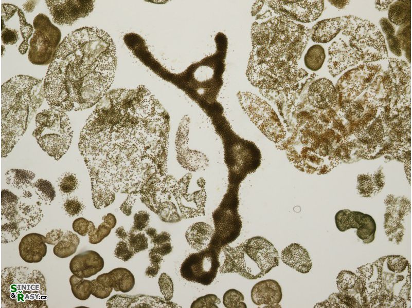 Microcystis spp.